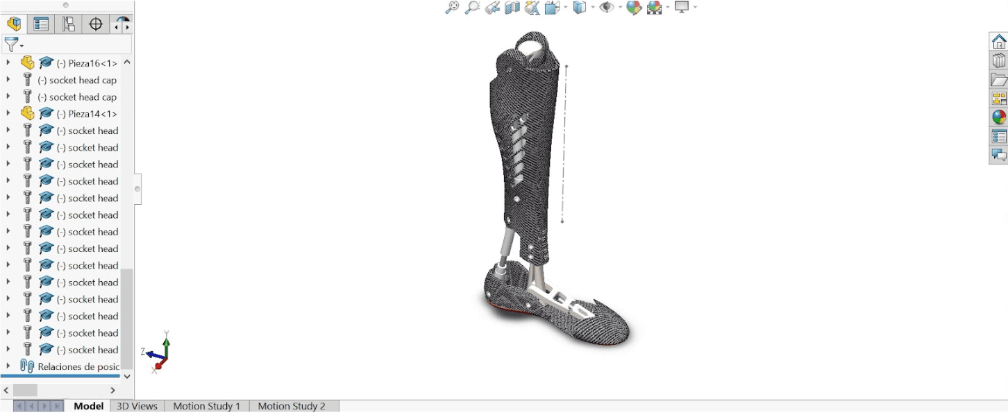 Prosthetic Leg with Modified Ankle - Image 1